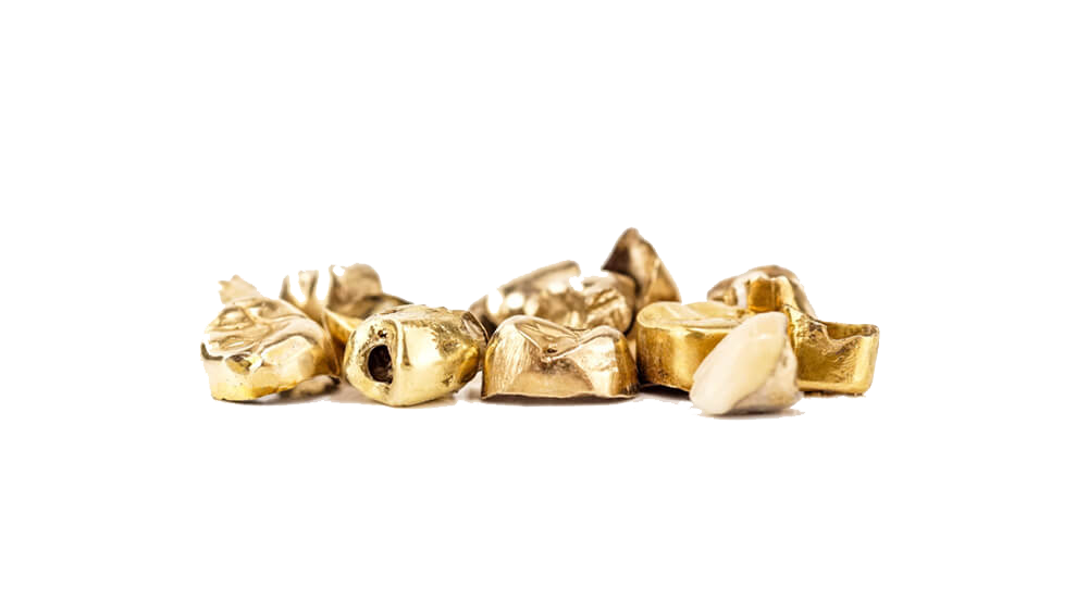 Zahngold verkaufen in Berlin